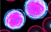 leukemia cells