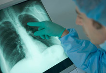 doctor looking at lung x-ray