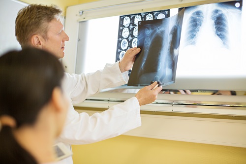 Male and female doctor reviewing pulmonary X-rays