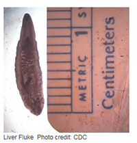 CDC image of a liver-fluke
